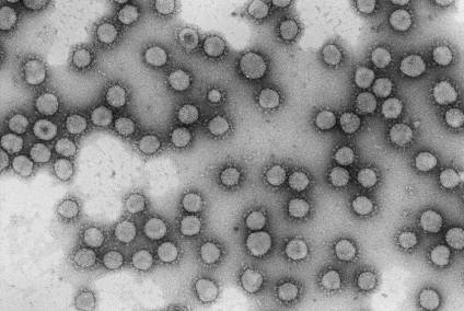 Virus de la familia Coronaviridae en blanco y negro