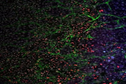 células madre más eficientes en medicina regenerativa