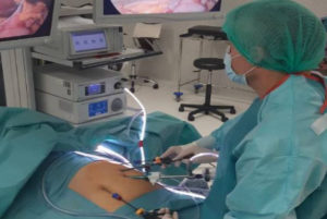 cirugia laparoscopica quironsalud