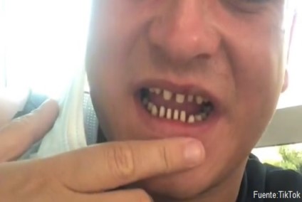 Turkey Teeth